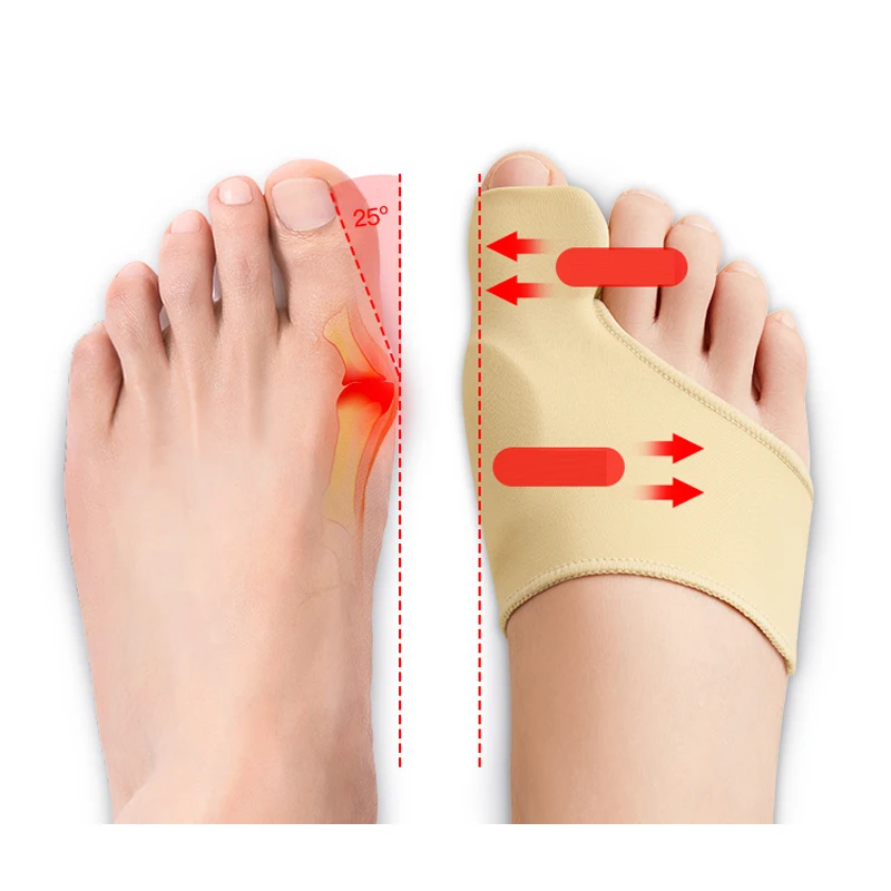 Corretores Ortopédicos Cuidados com os Pés